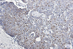 MMP3 Antibody in Immunohistochemistry (Paraffin) (IHC (P))