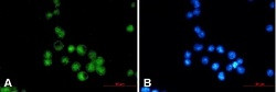 MEF2A Antibody in Immunocytochemistry (ICC/IF)