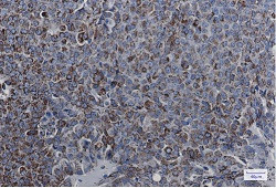 MDH2 Antibody in Immunohistochemistry (Paraffin) (IHC (P))