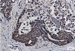 MDH2 Antibody in Immunohistochemistry (Paraffin) (IHC (P))