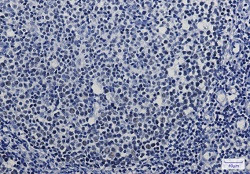 MBD2 Antibody in Immunohistochemistry (Paraffin) (IHC (P))