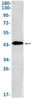 MAGEA3 Antibody in Western Blot (WB)