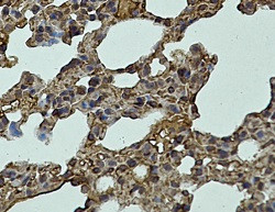 Lyve1 Antibody in Immunohistochemistry (Paraffin) (IHC (P))