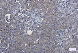 NR1H3 Antibody in Immunohistochemistry (Paraffin) (IHC (P))
