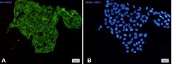LUM Antibody in Immunocytochemistry (ICC/IF)