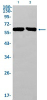 LRRC15 Antibody in Western Blot (WB)