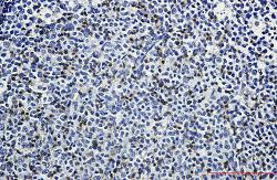 LAT Antibody in Immunohistochemistry (Paraffin) (IHC (P))