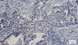 LMNB1 Antibody in Immunohistochemistry (Paraffin) (IHC (P))