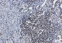 LMNB1 Antibody in Immunohistochemistry (Paraffin) (IHC (P))