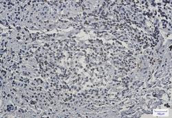 LBR Antibody in Immunohistochemistry (Paraffin) (IHC (P))