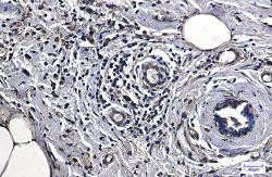 LDHA Antibody in Immunohistochemistry (Paraffin) (IHC (P))