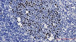 KIFC1 Antibody in Immunohistochemistry (Paraffin) (IHC (P))