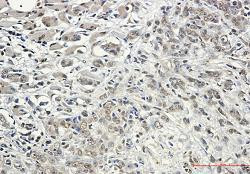 KIF5B Antibody in Immunohistochemistry (Paraffin) (IHC (P))