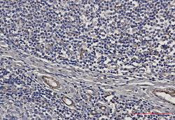 IRAK4 Antibody in Immunohistochemistry (Paraffin) (IHC (P))