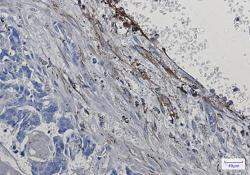 ITGA5 Antibody in Immunohistochemistry (Paraffin) (IHC (P))