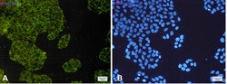 IGF2BP3 Antibody in Immunocytochemistry (ICC/IF)