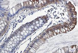 IL18 Antibody in Immunohistochemistry (Paraffin) (IHC (P))