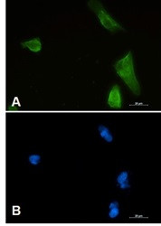 IKBKB Antibody in Immunocytochemistry (ICC/IF)