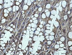 IGF2BP1 Antibody in Immunohistochemistry (Paraffin) (IHC (P))