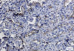ICAM1 Antibody in Immunohistochemistry (Paraffin) (IHC (P))