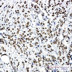 HSF1 Antibody in Immunohistochemistry (Paraffin) (IHC (P))