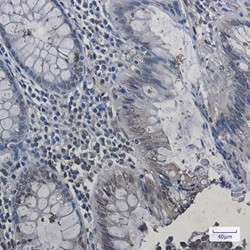 CBX5 Antibody in Immunohistochemistry (Paraffin) (IHC (P))