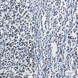 HNRNPM Antibody in Immunohistochemistry (Paraffin) (IHC (P))
