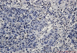 HNRNPK Antibody in Immunohistochemistry (Paraffin) (IHC (P))