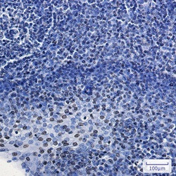 HMGA1 Antibody in Immunohistochemistry (Paraffin) (IHC (P))