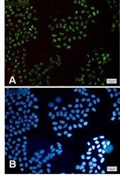 HLTF Antibody in Immunocytochemistry (ICC/IF)