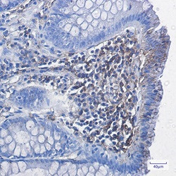HLA-A Antibody in Immunohistochemistry (Paraffin) (IHC (P))
