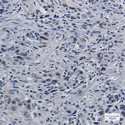 H3-3A Antibody in Immunohistochemistry (Paraffin) (IHC (P))
