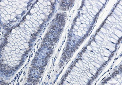 H2AX Antibody in Immunohistochemistry (Paraffin) (IHC (P))