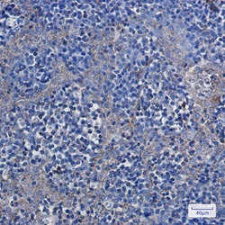 HK1 Antibody in Immunohistochemistry (Paraffin) (IHC (P))
