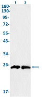 GSTP1 Antibody in Western Blot (WB)