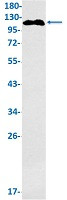 GHR Antibody in Western Blot (WB)