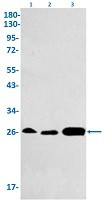 GSTM1 Antibody in Western Blot (WB)