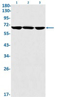 GLS Antibody in Western Blot (WB)
