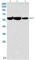 G6PD Antibody in Western Blot (WB)