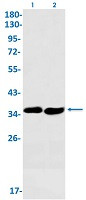 SMN1 Antibody in Western Blot (WB)