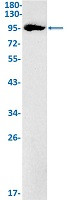 KAT2A Antibody in Western Blot (WB)