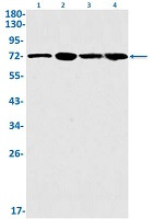 GCLC Antibody in Western Blot (WB)