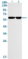 FTO Antibody in Western Blot (WB)