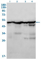 FH Antibody in Western Blot (WB)