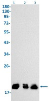 EIF4EBP1 Antibody in Western Blot (WB)