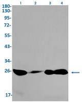 Phospho-EIF4E (Ser209) Antibody in Western Blot (WB)