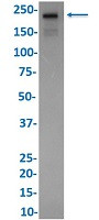 DNMT1 Antibody in Western Blot (WB)