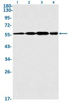 DKC1 Antibody in Western Blot (WB)
