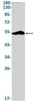 DGAT1 Antibody in Western Blot (WB)