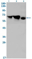 DDX5 Antibody in Western Blot (WB)